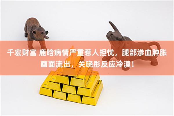 千宏财富 鹿晗病情严重惹人担忧，腿部渗血肿胀画面流出，关晓彤反应冷漠！